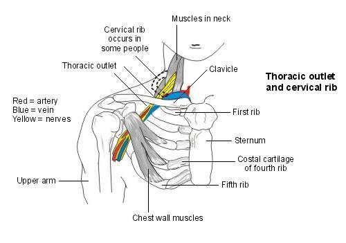 thoracic outlet and cervical rib