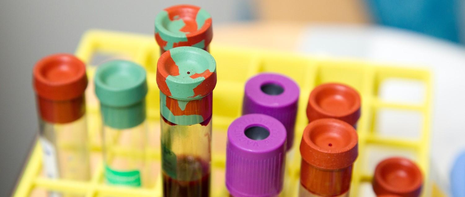How to get over a fear of blood tests